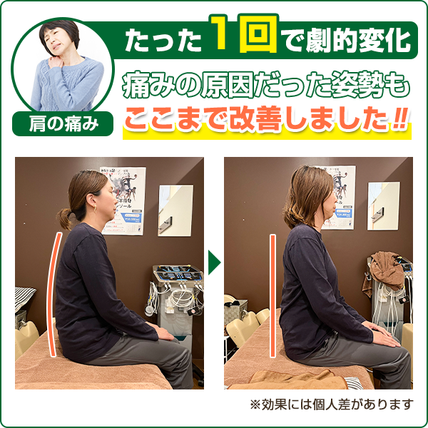 ビフォーアフター