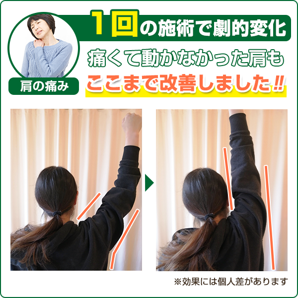 ビフォーアフター