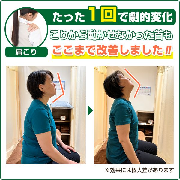 ビフォーアフター