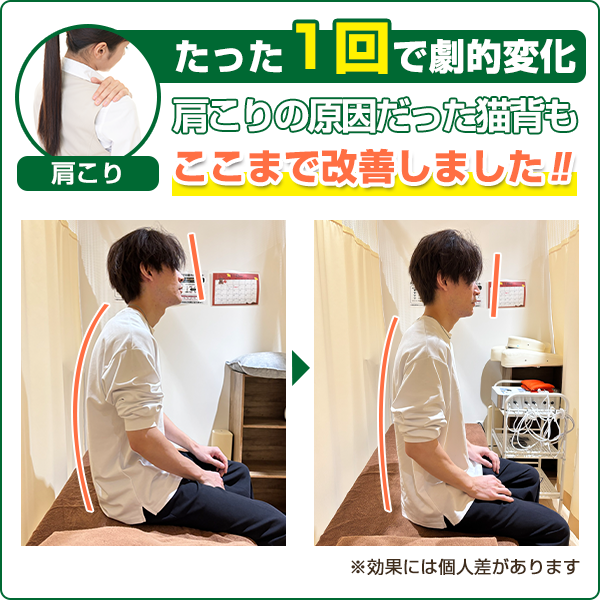 ビフォーアフター