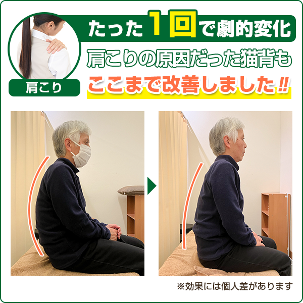 ビフォーアフター