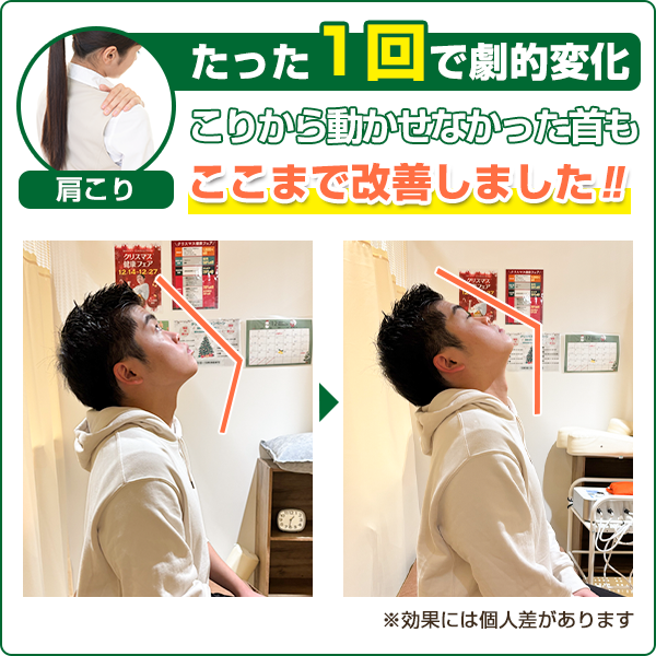 ビフォーアフター