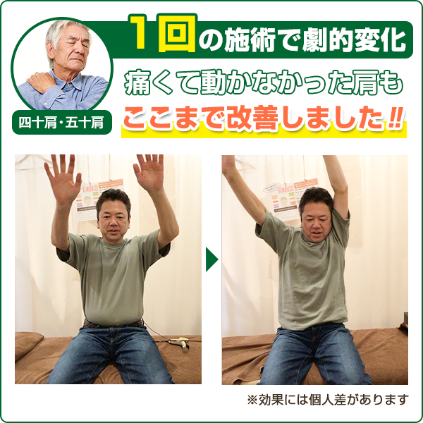 ビフォーアフター